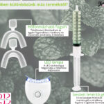 Facebook bejegyzés 940x788 px (13) UV-lámpás fogfehérítő kezdő szett + utántöltő válogatás