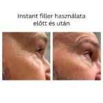 INSTANT FILLER gyors hatású randiszérum 30ml