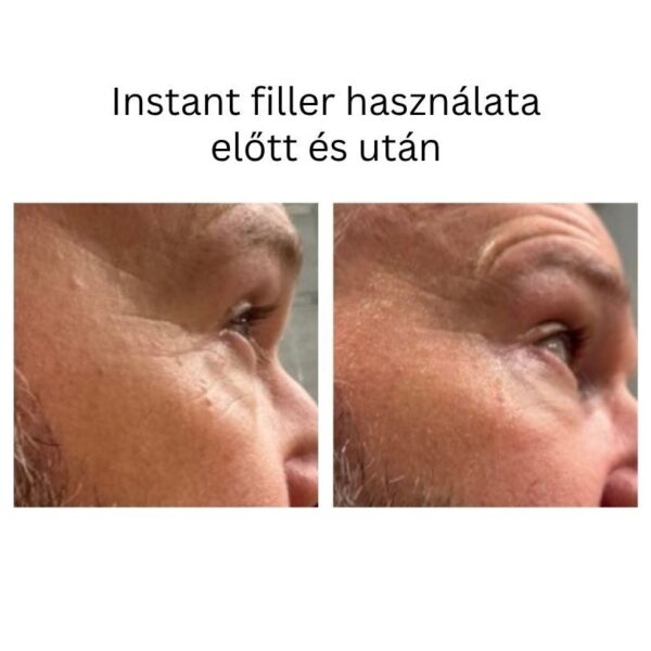 INSTANT FILLER gyors hatású randiszérum 30ml