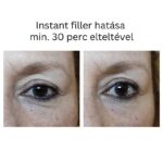 INSTANT FILLER gyors hatású randiszérum 30ml