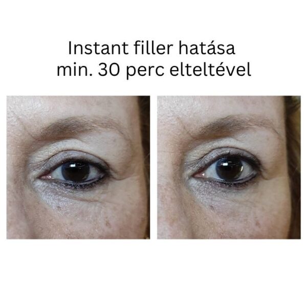 INSTANT FILLER gyors hatású randiszérum 30ml