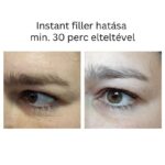 INSTANT FILLER gyors hatású randiszérum 30ml