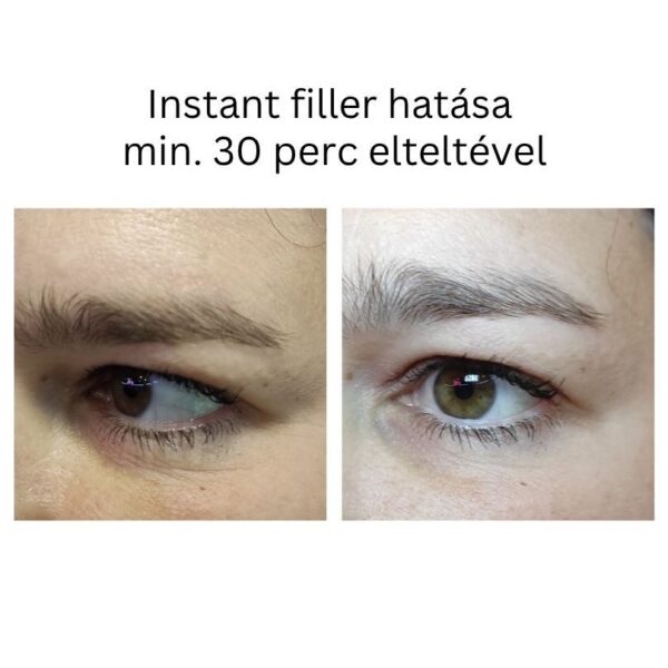 INSTANT FILLER gyors hatású randiszérum 30ml