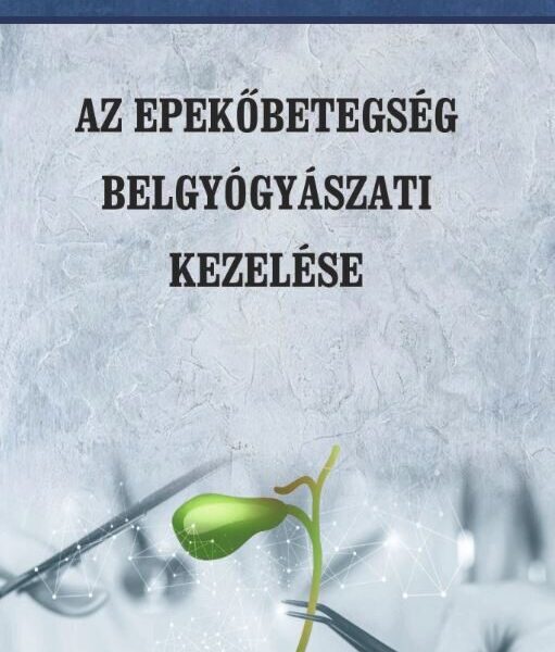 Az epekőbetegség belgyógyászati kezelése